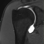 Arthrographie