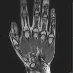 Hand